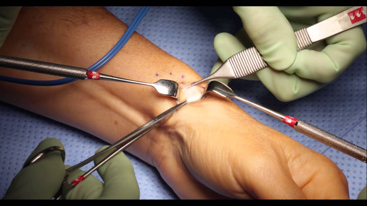 Surgery